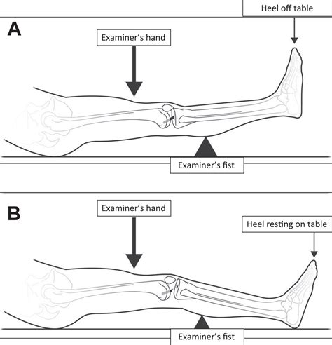 accuracy of lelli test for anterior cruciate ligament tear|lelli vs lachman test.